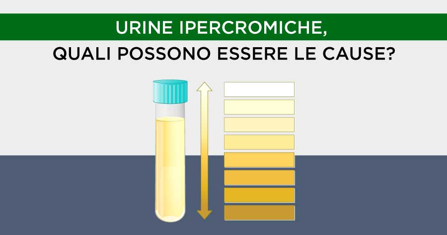 urine-ipercromiche-quali-possono-essere-le-cause-igea-santimo