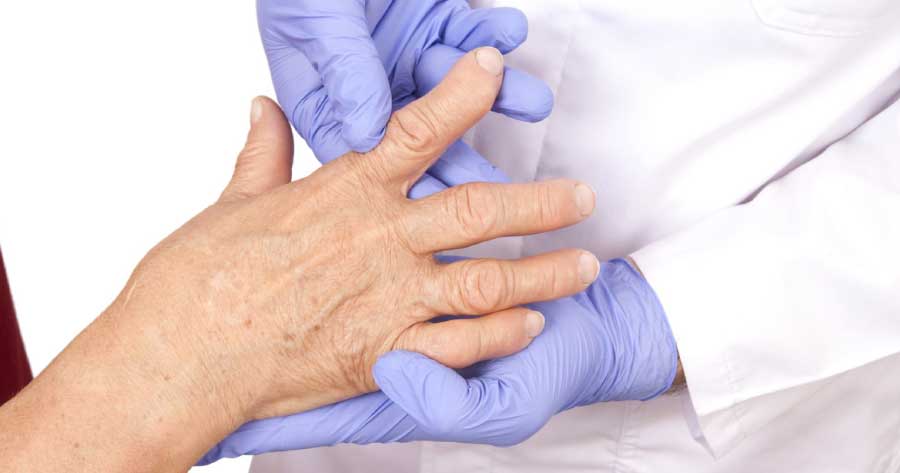 artrite-reumatoide-gli-esami-per-diagnosticarla-igea-santimo