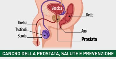 Cancro della prostata, salute e prevenzione
