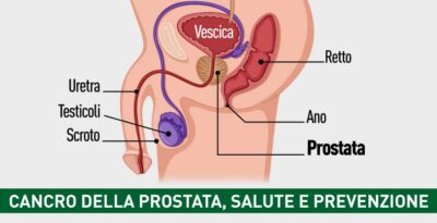 Cancro della prostata, salute e prevenzione